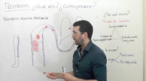Trombosis Venosa trombosis venosa cerebral