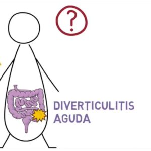 Diverticulosis Diverticulosis colonica