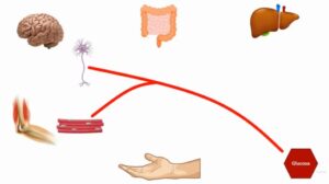 Diabetes Mellitus Diabetes Mellitus gestacional